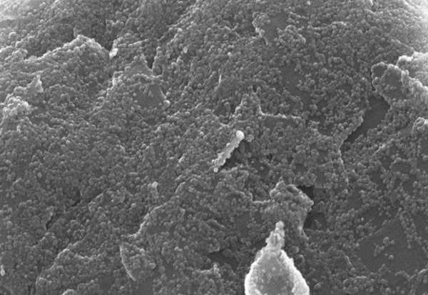 Particle surface texture under microscope